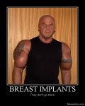 implants.jpg