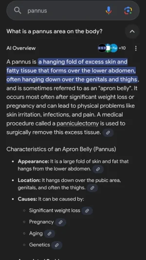 Screenshot_20250918_202840_Google.webp