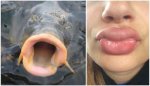 550x315xkylie-jenner-fish-lips-02-550x315.jpg