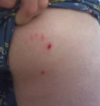 dogbite.jpg